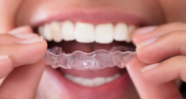 Teeth Whitening | Teeth Whitening Gel