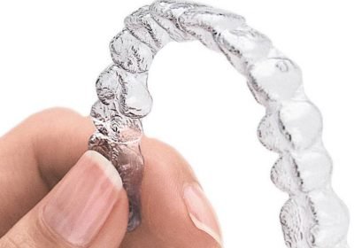 Pro White Smile | Teeth whitening